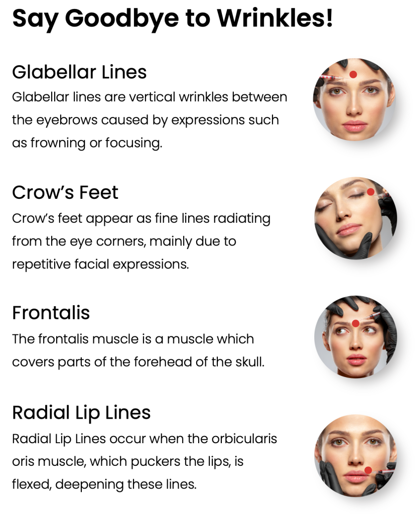 Botox solutions